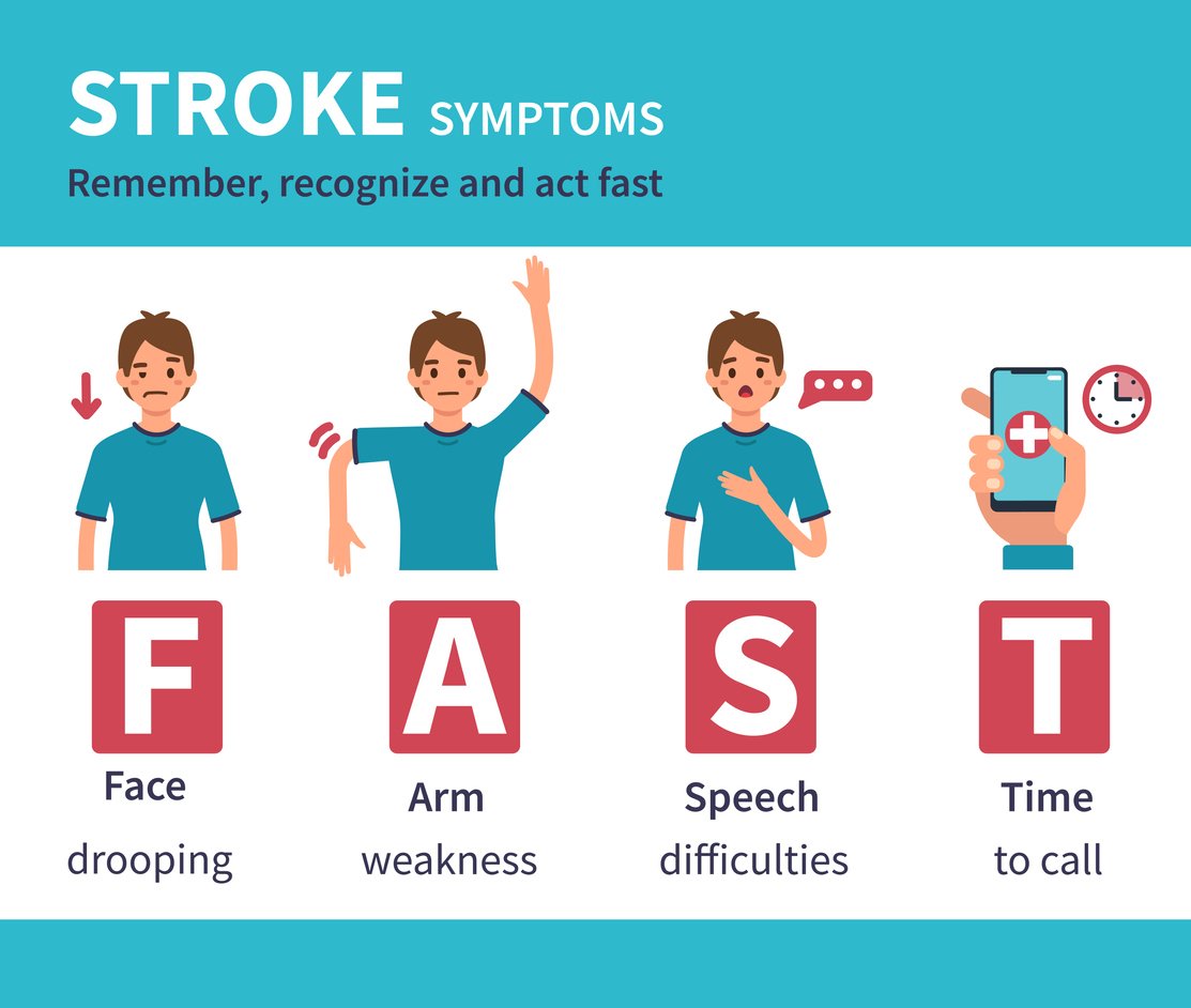 Symptoms of a stoke Act Fast